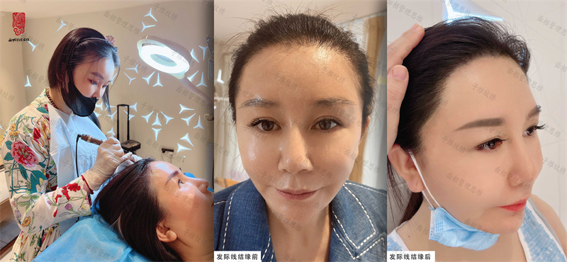 发际线 微信图片_20220921133515.jpg