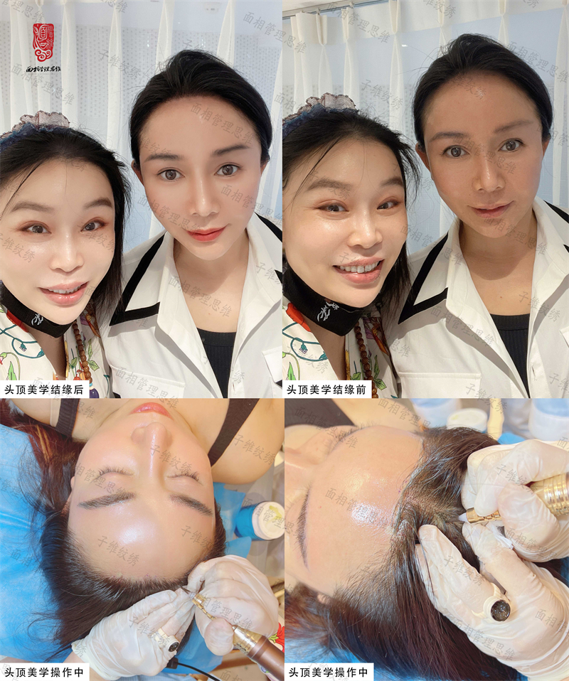 发际线 微信图片_20220921133547.jpg